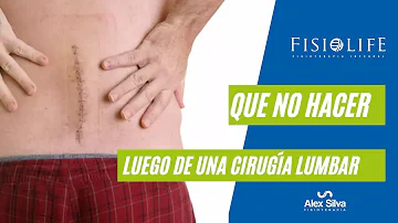 ¿Cómo puedo fortalecer el tronco después de una artrodesis vertebral?