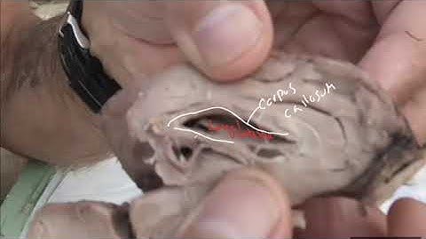 Sheep brain dissection part 2