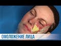 Омоложение лица: Эндоскопический лифтинг лица (подтяжка лица) Пластический хирург -Андрей Ворошкевич