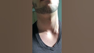 My visible neck pulse
