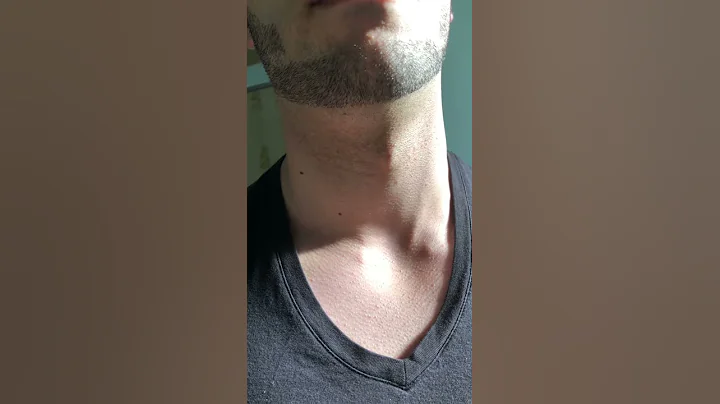 My visible neck pulse