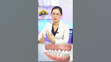 Niềng răng một hàm có được không?