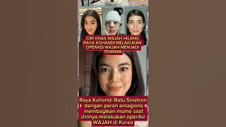 FACIAL FEATURES LOST‼️ Raya Kohandi Undergoes Facial Surgery to Become Feminine in Korea