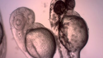 Zebrafish larvae heartbeats