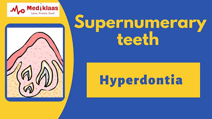 Supernumerary Teeth l Hyperdontia l Developmental disturbance of teeth l Mediklaas - DayDayNews