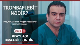 Trombaflebit Nedir - Dr Vuqar Fettah-Pur Fleboloq Cerrah Medplus Tv