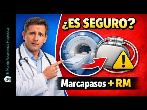 ¡CUIDADO! Esto sucede cuando un marcapasos entra en una resonancia resonancia magnetica