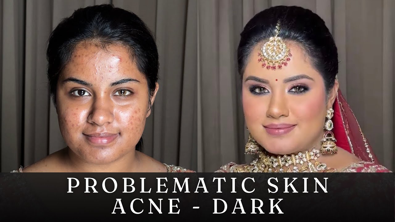 Full tutorial of Acne prone skin, Dark & tan skin - Flawless Bridal Makeup 