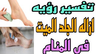 تفسير رؤيه ازاله الجلد او تقشير الجلد في المنام| للرجل و متزوجه و العزباء و الحامل