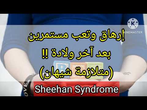 متلازمة شيهان  