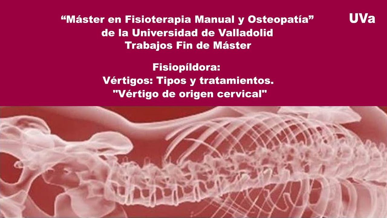 medicamentos+para+el+vertigo+cervical