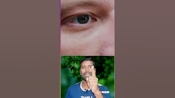 test Your Eyes 👀 | #iqtest #riddles #puzzle #emojiquizes #testyoureyes #shortvideo #shorts #eyes #yt