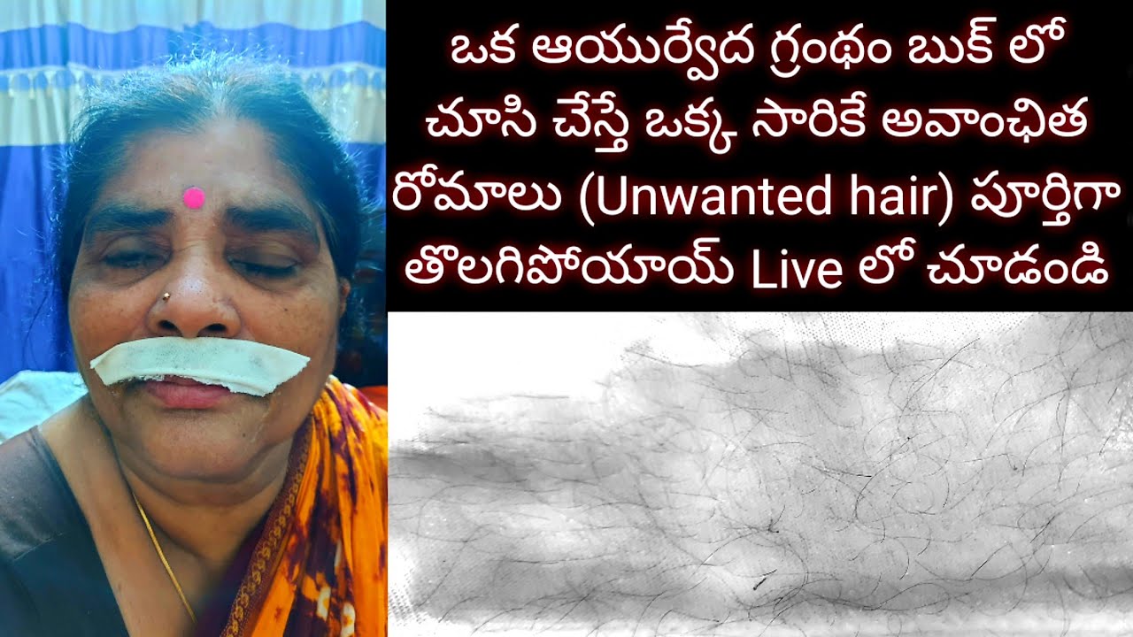 ఒక ఆయుర్వేద గ్రంథం బుక్ లో చూసిచేస్తే ఒక్కసారికే అవాంఛిత రోమాలు (Unwanted hair)పూర్తిగా తొలగిపోయాయ్