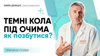 ТЕМНІ КОЛА ПІД ОЧИМА: ПРИЧИНИ, ЯК ПОЗБУТИСЯ?