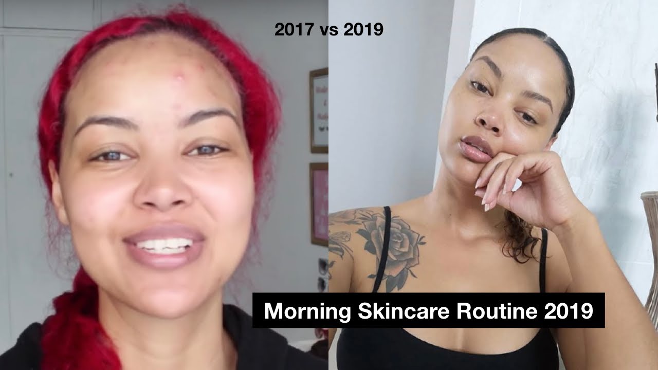 My clearest skin ever | South African Youtuber - YouTube
