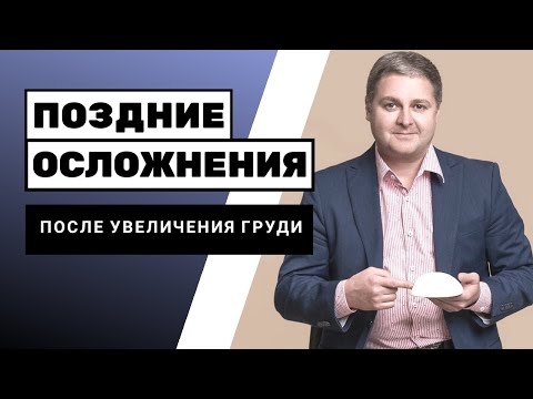 Видео: Покрывает ли страховка увеличение груди при асимметрии?