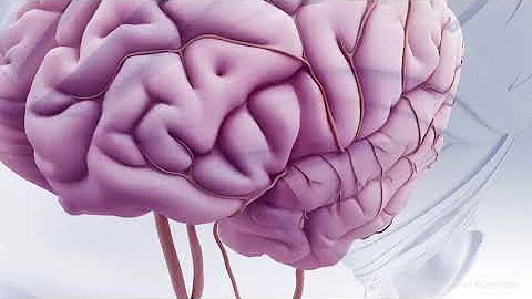 Ischemic Stroke With tPA Animation
