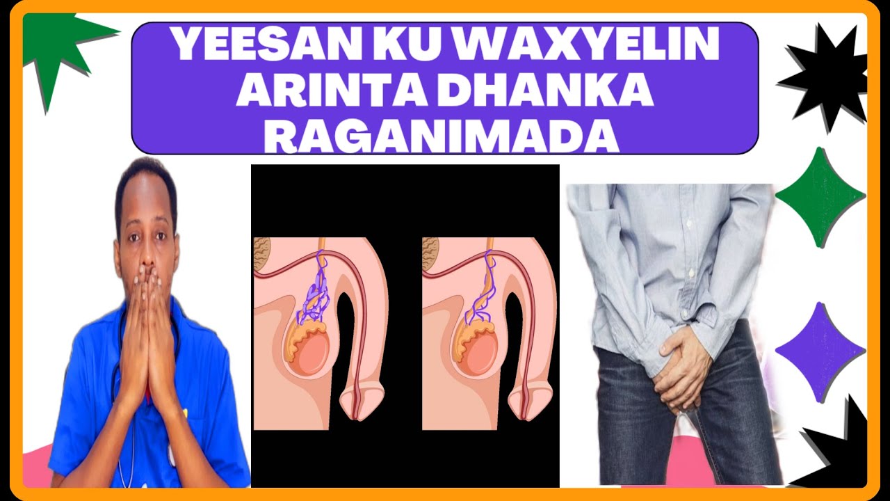 VARICOCELE WAXA SABABA CALAMADAHA LAGU GARTO DHALMA YARI  SABABTO SIDE LO DAWEYO DR. MAHAMED LIBAAN