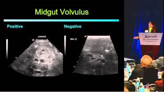 Ultrasound First and the Pediatric Abdomen  Lynn Fordham, MD