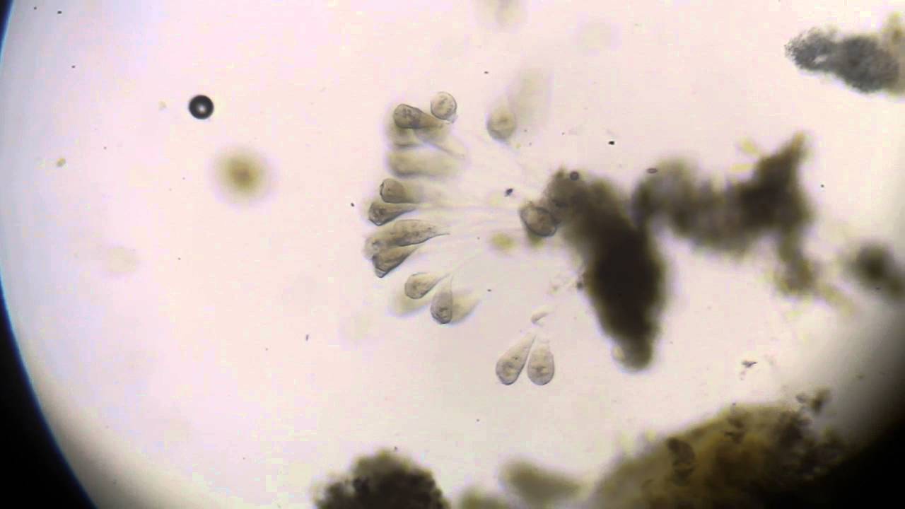 Colonial ciliates (Peritrichia). Maybe Vorticella sp. (Инфузории сувойки)
