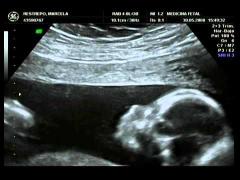 Vídeo: 33 Setmanes D'embaràs: Sensacions, Desenvolupament Fetal, Ecografia