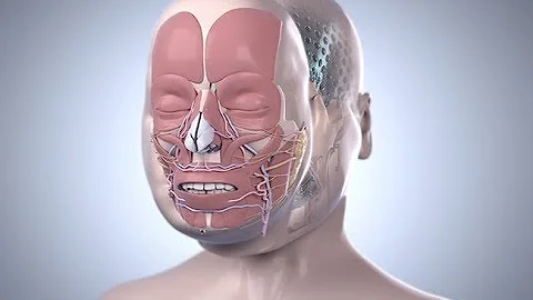 Cleveland Clinic's First Total Face Transplant | K...