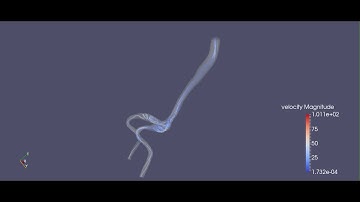 Blood flow inside Normal Aorta