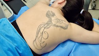 Process of Removing Bad Tattoo. Laser Tattoo Removal Korean Doctor by All process of world 58,667 views 4 months ago 9 minutes, 6 seconds