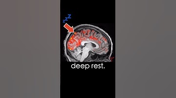 Your Brain Washes itself when you SLEEP! #neuroscience