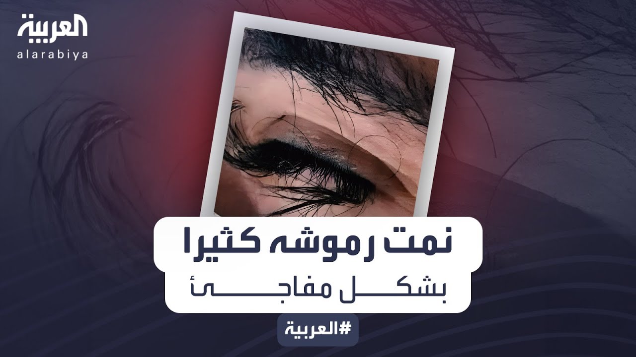       
 - نشر قبل 5 ساعة