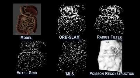Augmented Reality for Depth Cues in Monocular Minimally Invasive Surgery