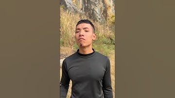 How I Cured a Bug Bite with Yogurt in the Wild | Survival Hacks👃👈😣😢🤪 #funny #entertainment #nose