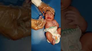 Suction process dr remove bad wayer from stomach and cleaned it carefully newborn baby