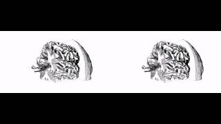 DTI in Context: Illustrating Brain Fiber Tracts In Situ (3D)