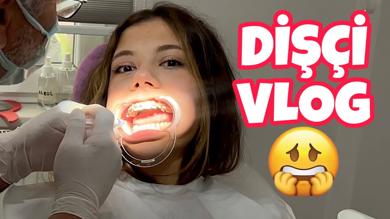 DİŞ TELLERİM YENİDEN TAKILIYOR !! Eyvahlar Olsun ⁉️ Günlük Vlog. Tuana Zeybek