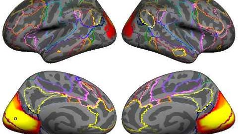 Yeo_etal_JNeurophysiol_2011_Visual.avi