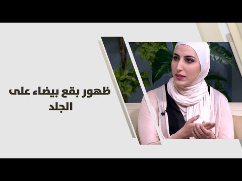 فيديو: لماذا تحتوي هولي على بقع - تشخيص أوراق هولي بالبقع البيضاء