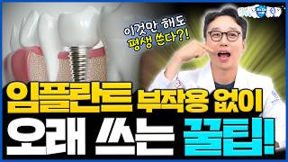 임플란트 오래 쓰는 사람들은 다 쓴다는 이것?