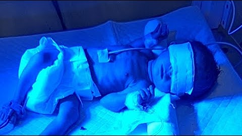 baby jaundice treatment on photography lights#newbornbaby #cute  #love #youtube #viral #trending