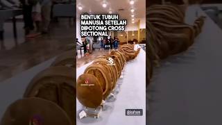Cadaver, tubuh manusia dipotong #shorts