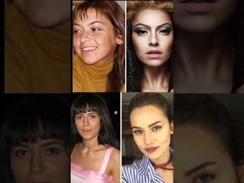 ÜNLÜLERİN ESTETİKSİZ HALİ