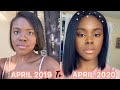 MY RELAXED HAIR JOURNEY (one year) | Hair Growth Journey