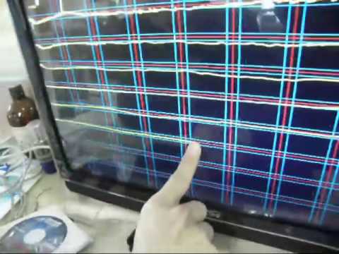 Video: Diagnosticul și Evaluarea Fenotipică A Trimetilaminuriei și Tratamentul Acesteia Cu Riboflavină: Spectroscopie RMN 1 H și Testare Genetică