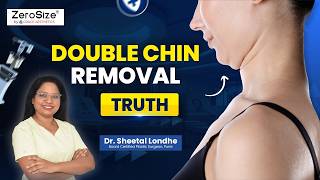 Say Goodbye to Stubborn Neck Fat! VASER Double Chin Surgery Explained | Dr. Sheetal Londhe ZeroSize®