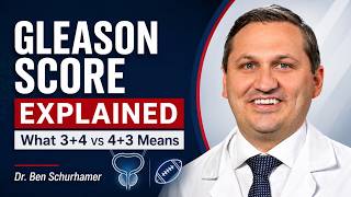 How do I understand my Gleason score? Prostate Biopsy explained