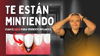 ¡Te están mintiendo! Usan el miedo para venderte implantes dentales