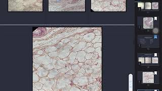 Areolar, Adipose, and Reticular Connective Tissues