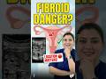 The Truth About Fibroids & IVF Failure