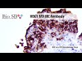 Bio sb  2021 new heg1 antibody for ihc