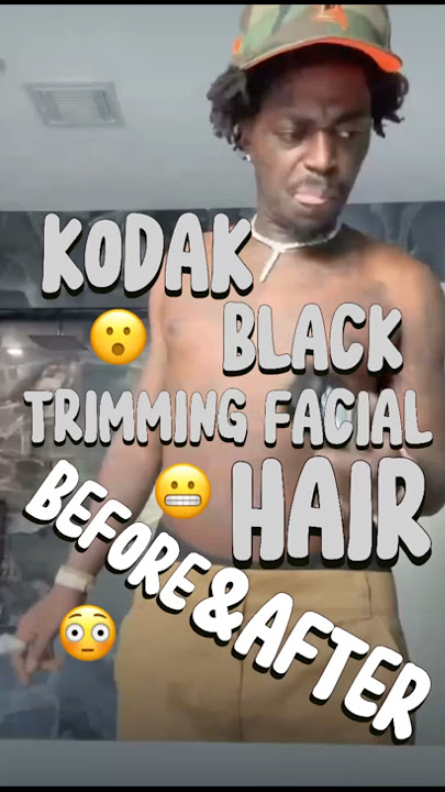 (MUST WATCH) Kodak Trimming Facial Hair FAIL! #kodakblack #fyp #viralshorts #hiphop #funny #shorts
